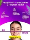 Фото превью товара - #1